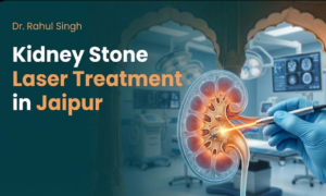 Kidney Stone Laser Treatment In Jaipur